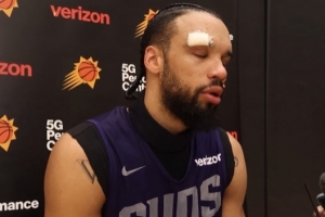 是谁干的？狄龙：训练中被队友用肘部撞到了额头 我缝了六针