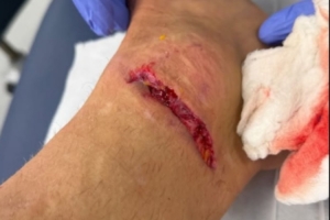 丹索：迪涅在场边我向他道了歉，确实碰到了他，但我明显先清了球